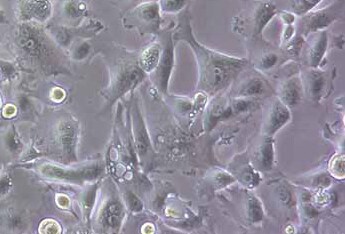 NCI-H226人肺鳞癌细胞系 NCI-H226 human lung squamous cell carcinoma cells