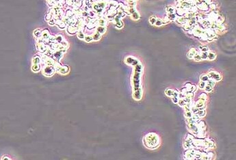 y79人视网膜母细胞瘤细胞系 Y79 human retinoblastoma