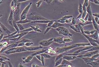 HELF (人胚肺成纤维细胞系) HELF (human embryonic lung fibroblast)