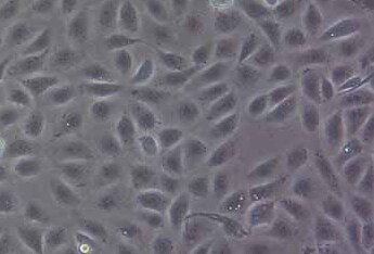 5637 (人膀胱癌细胞系) (STR鉴定正确) 5637 (human bladder cancer cell) (STR identification correct)