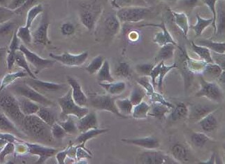 SK-OV-3人卵巢癌细胞系 SK-OV-3 human ovarian cancer cells