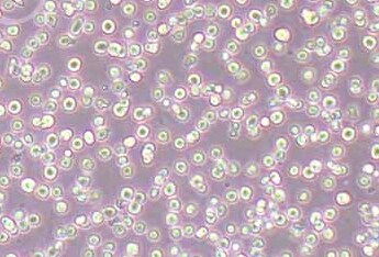 CEM/C1人急性淋巴细胞白血病细胞系 CEM/C1 human acute lymphoblastic leukemia cells
