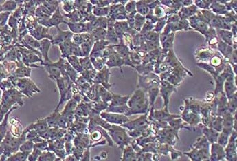 SK-N-MC人神经上皮瘤细胞系 SK-N-MC human neuroepithelial tumor cells