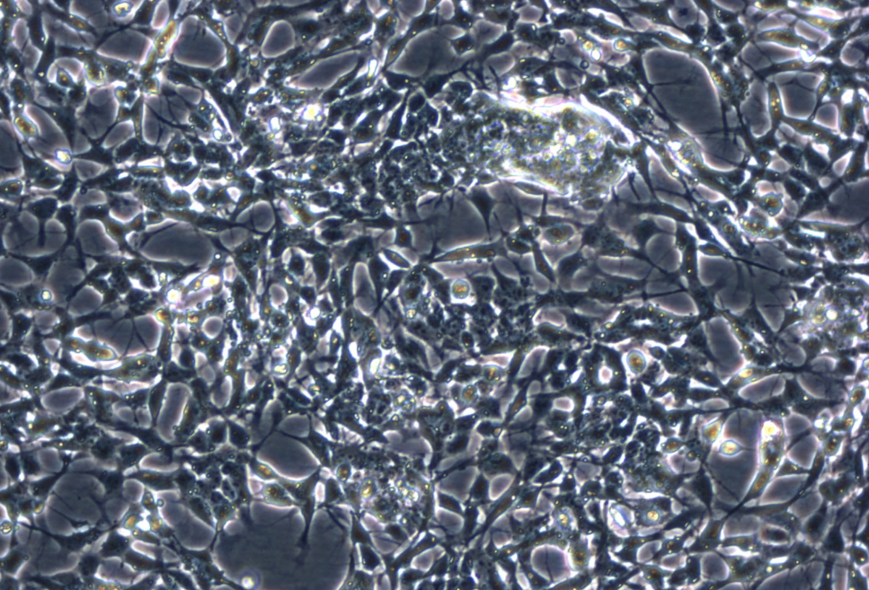 IMR-32 (人神经母细胞瘤细胞系) IMR-32 (human neuroblastoma cells)