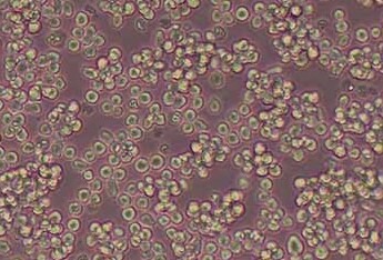 MOLT-4 (人急性淋巴母细胞白血病细胞系) (STR鉴定正确) MOLT-4 (human acute lymphoblastic leukemia cells)