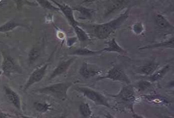 SW 982 [SW-982, SW982] (人滑膜肉瘤细胞系) (STR鉴定正确) SW 982 [SW-982, SW982] (human synovial sarcoma cells)