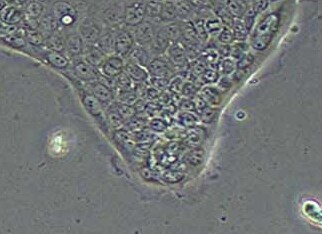 Capan-2人胰腺癌细胞系 Capan-2 human pancreatic cancer cells