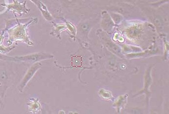 NOZ (人胆囊癌细胞系) NOZ (human gallbladder cancer cells)
