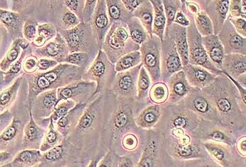 SCC-25 [SCC 25; SCC25] (人舌磷癌细胞系) SCC-25 [SCC 25; SCC25] (human tongue squamous cell carcinoma)