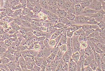 C643 (人甲状腺癌细胞系) (STR鉴定正确) C643 (human thyroid cancer cells) (STR identification correct)