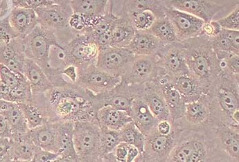 TU686人喉癌细胞系 TU686 human laryngeal cancer cells
