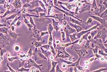 NCI-H446人小细胞肺癌细胞系 NCI-H446 human small cell lung cancer cells