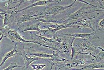 SW579人甲状腺癌细胞系 SW579 human thyroid cancer cells