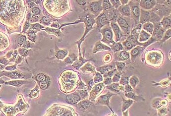 NCI-H508人结肠直肠腺癌细胞系 NCI-H508 human colorectal adenocarcinoma cells