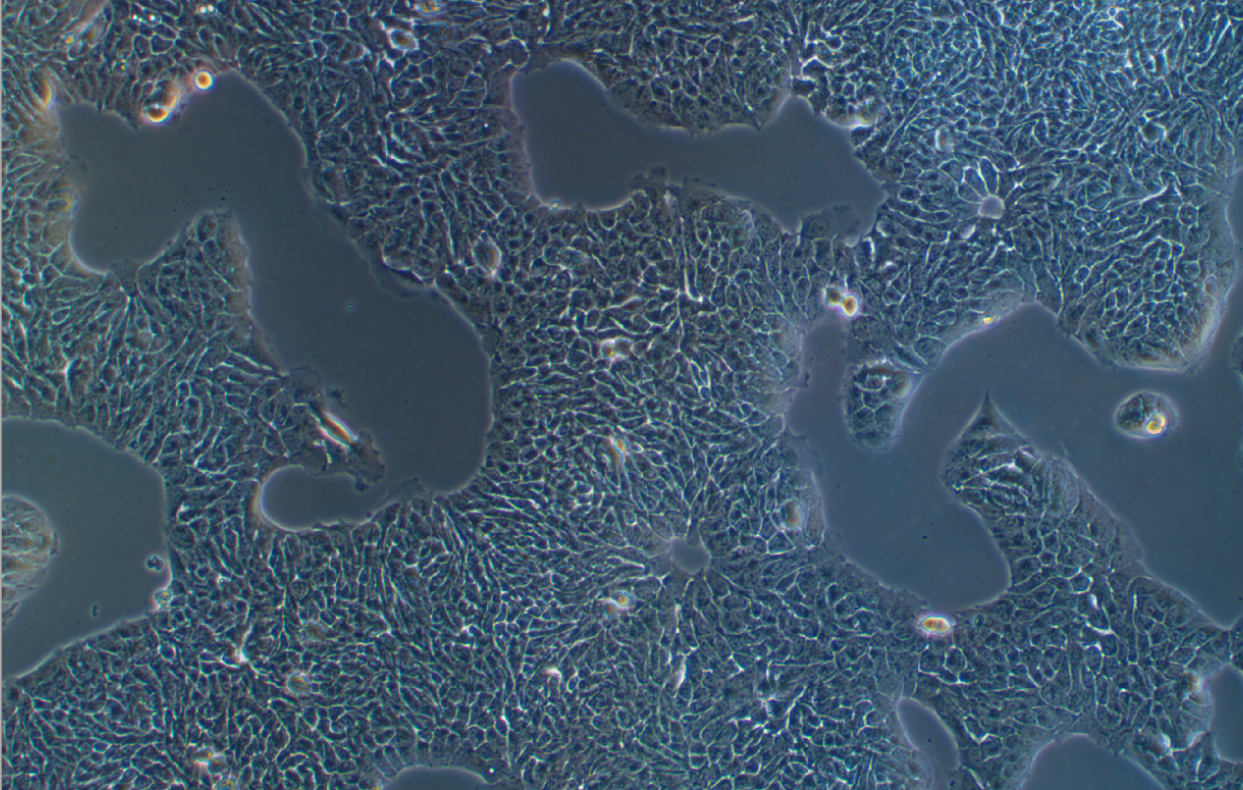 RT4人膀胱移行细胞系乳头瘤 RT4 human bladder transitional cell papilloma