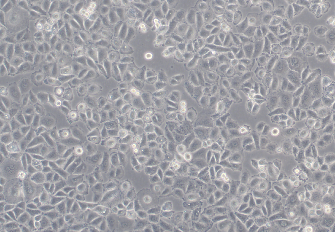 NCI-H838 (人非小细胞肺癌细胞系) (STR鉴定正确)