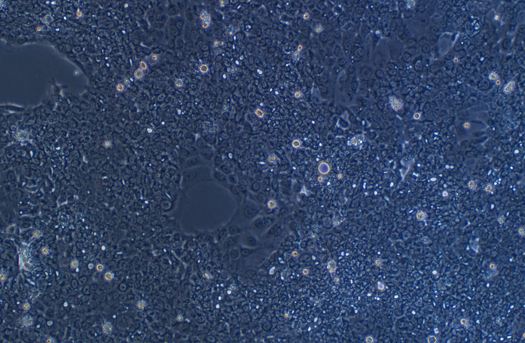 HPAC (人胰腺腺泡上皮癌细胞系) HPAC (human pancreatic acinar epithelial carcinoma)