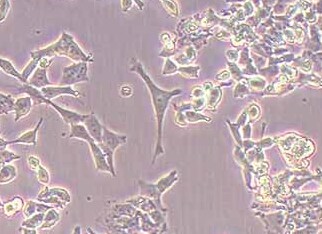 D283 Med (人脑髓母细胞瘤细胞系) D283 human medulloblastom