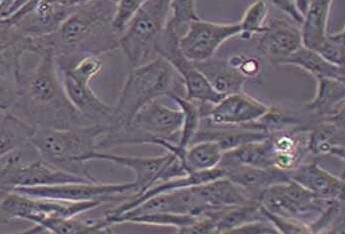 WPMY-1人正常前列腺基质细胞(永生化细胞） WPMY-1 (human normal prostate stromal immortalized cells)