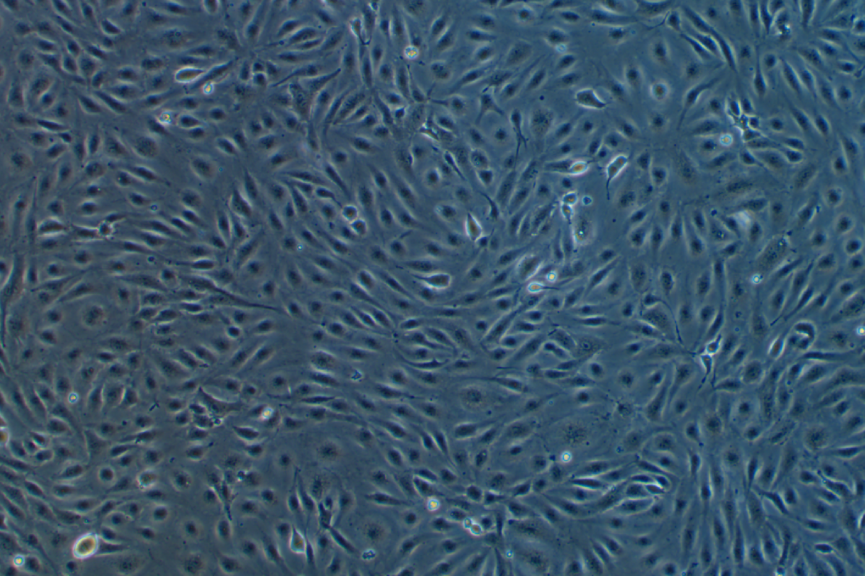 人肝窦内皮细胞(永生化细胞） Human sinusoidal endothelial cells (immortalized)