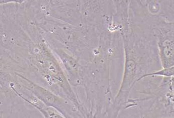 人牙髓干细胞(原代细胞) Human dental pulp stem cells