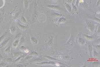人冠状动脉内皮细胞(原代细胞) Human coronary artery endothelial cells