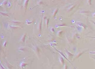 人肾小球系膜细胞(原代细胞) Human glomerular mesangial cells