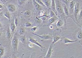 HUVEC+RFP人脐静脉内皮细胞（荧光示踪细胞）(永生化细胞） HUVEC+RFP human umbilical vein endothelial cell immortalization+RFP