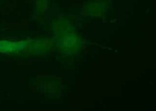 HUVEC+GFP人脐静脉内皮细胞（荧光示踪细胞）(永生化细胞） HUVEC+GFP human umbilical vein endothelial cell immortalization+GFP