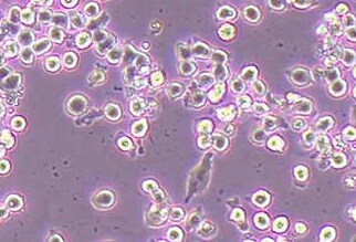 MIA-PACA-2/GEM 人胰腺癌吉西他滨耐药株 MIA-PACA-2/GEM human pancreatic cancer gemcitabine resistant strain