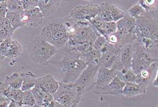 MCF-7/ADR人乳腺癌阿霉素耐药株 MCF-7/ADR human breast cancer adriamycin resistant strain