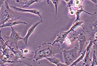 U251 MG/TMZ人类星形胶质瘤耐替莫唑胺耐药株 U251 MG/TMZ human astrocyte resistant to temozolomide