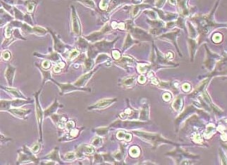 人结肠癌耐奥沙利铂细胞株hct116/L Human colon cancer oxaliplatin resistant cell line hct116/L
