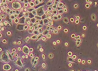 MKN-45/DDP人胃癌顺铂耐药株 MKN-45/DDP human gastric cancer cisplatin resistant strain