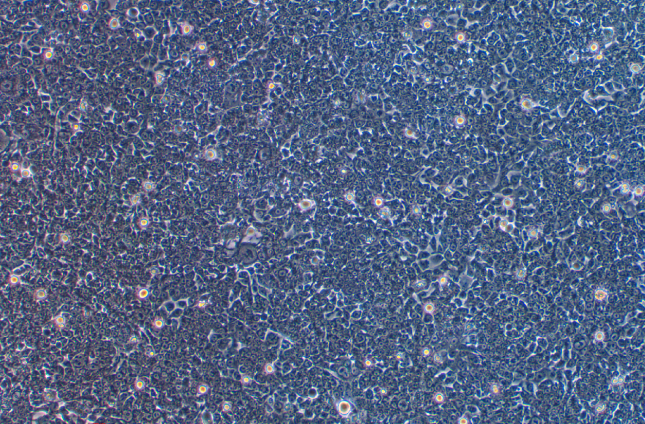 人结肠癌氟尿嘧啶耐药株hct116/FU Human colon cancer fluorouracil resistant strain hct116/FU