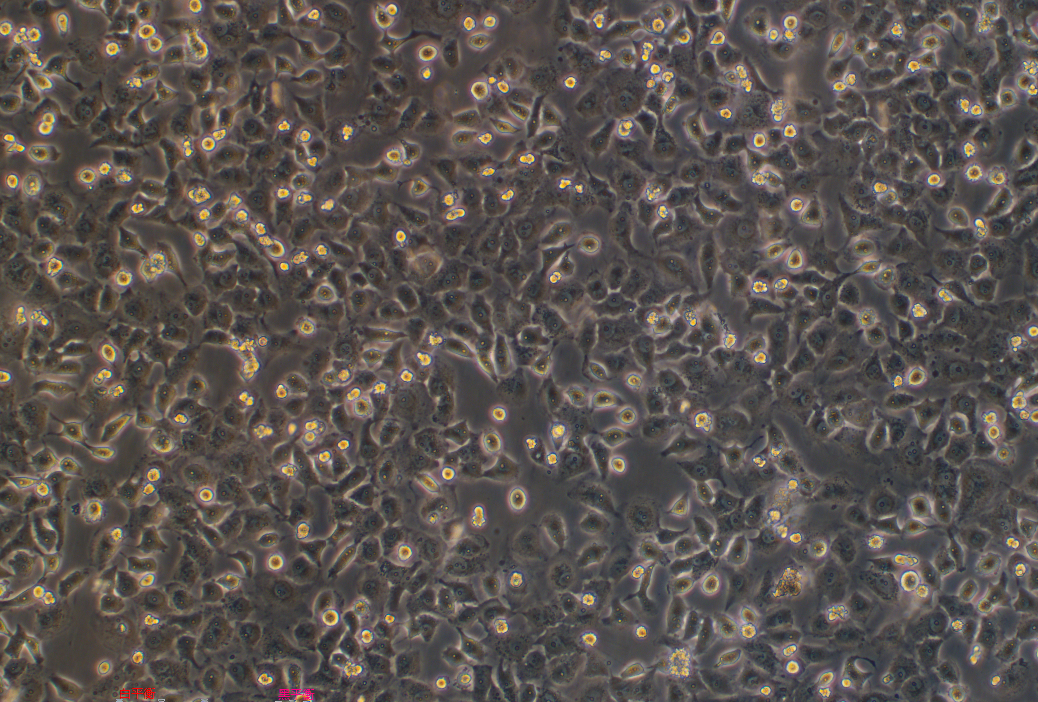 人胃癌顺铂耐药株SGC7901/DDP Human gastric cancer cisplatin resistant strain SGC7901/DDP