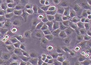 HO8910PM-LUC-PURO人卵巢癌细胞（荧光示踪细胞）+LUC HO8910PM-LUC-PURO human ovarian cancer cells+LUC