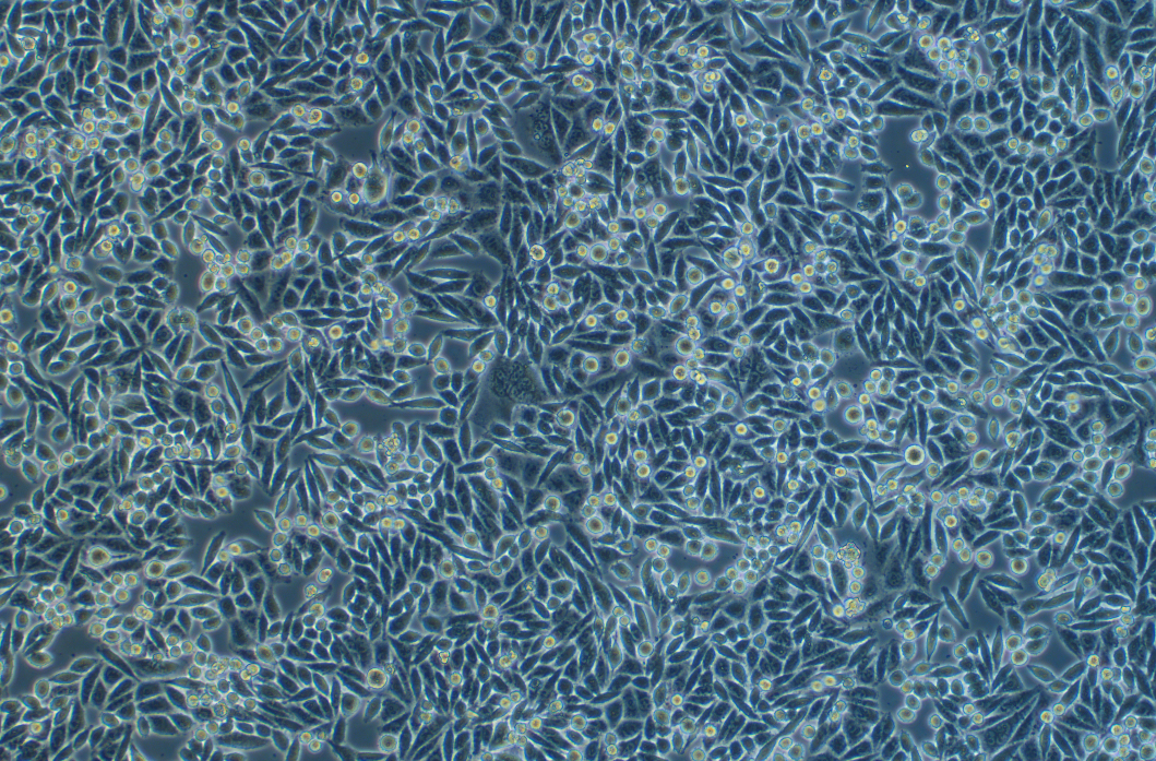 SW480-LUC-puro人结肠腺癌细胞（荧光示踪细胞）+LUC SW480-LUC puro human colon adenocarcinoma cells+LUC