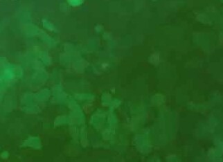 MHCC-97H-LUC-EGFP人高转移性肝癌细胞（荧光示踪细胞） MHCC-97H-LUC-EGFP Human highly metastatic liver cancer cells