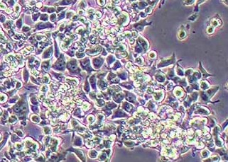 mkn-45-luc-puro人胃癌细胞(荧光示踪细胞)+luc Mkn-45-luc-puro human gastric cancer cells+luc