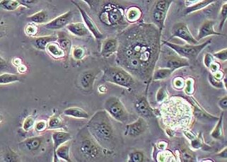 AGS-plv-luc-puro人胃癌细胞（荧光示踪细胞）+luc AGS plv luc puro human gastric cancer cells+luc