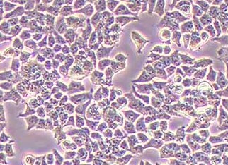 PC3-LUC-BSD人前列腺癌细胞(荧光示踪细胞) PC3-LUC-BSDhuman prostate cancer cells