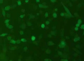 MKN-28-luc-EGFP人胃癌高转移细胞（荧光示踪细胞） MKN-28-luc-EGFP Human gastric cancer highly metastatic cells