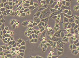 NCI-H1703-Luc人肺鳞癌细胞(荧光示踪细胞) NCI-H1703-Luc Human lung squamous cell carcinoma cells
