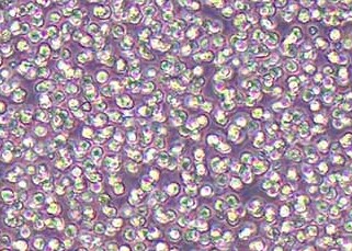 MV4-11-LUC-eGFP-puro人淋巴瘤细胞AML（荧光示踪细胞）+LUC+eGFP MV4-11-LUC eGFP puro lymphoma cells+LUC+eGFP
