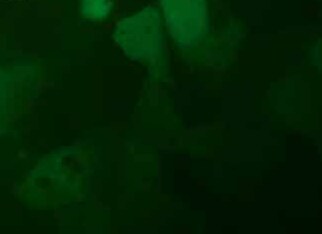 HEP3B-LUC-EGFP人肝癌细胞（荧光示踪细胞） HEP3B-LUC-EGFP human liver cancer cells