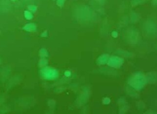 NCI-H1299-luc-EGFP人非小细胞肺癌细胞(荧光示踪细胞) NCI-H1299-luc-EGFP Human non-small cell lung cancer cells