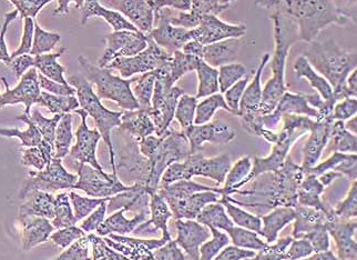 HEP3B-LUC-PURO人肝癌细胞(荧光示踪细胞)+LUC HEP3B-LUC-PURO human liver cancer cells - luciferase labeling