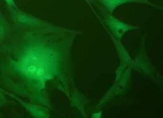 U87-MG-LUC-EGFP人脑胶质瘤细胞（荧光示踪细胞） U87-MG-LUC-EGFP Human glioma cells