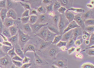 A549-LUC-PURO人肺癌细胞(荧光示踪细胞) A549-LUC-PURO human lung cancer cells